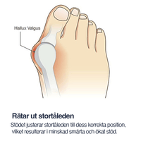 Korrigering hallux valgus-støtte med tåspreder (2-pak)
