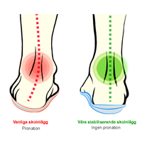 Pronationsindlæg – halv sål med støtte ved overpronation